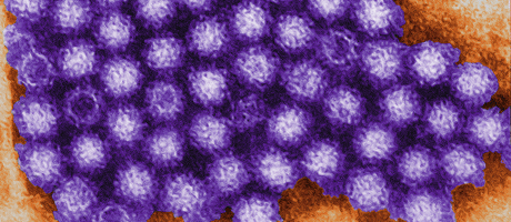 Norovirus virions or virus particles