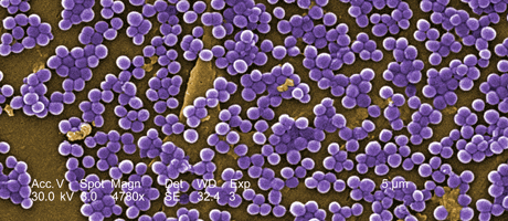 Staphylococcus MRSA aureus