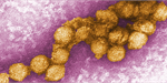 West Nile virus